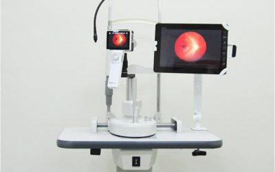 5 retinographers for Primary Care in Lanzarote