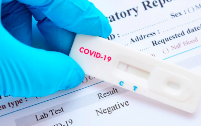 Health authorizes 33 laboratories to carry out COVID-19 diagnostic tests