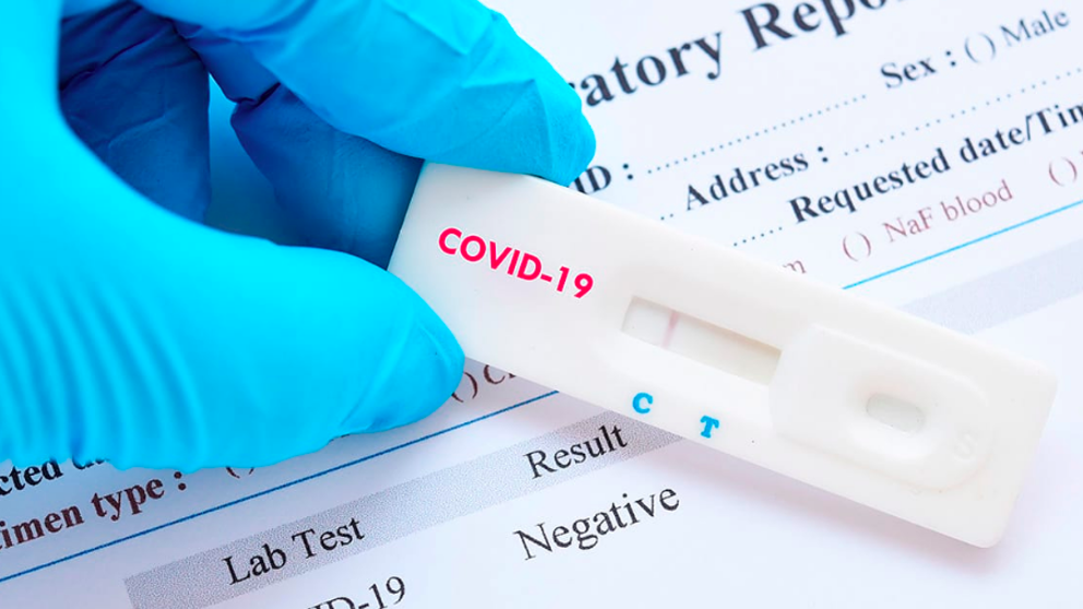 Health authorizes 33 laboratories to carry out COVID-19 diagnostic tests